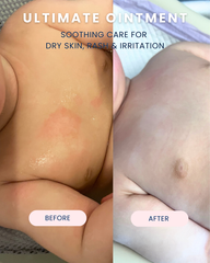 Ultimate Ointment, 10 oz.