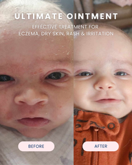 Ultimate Ointment, 10 oz.